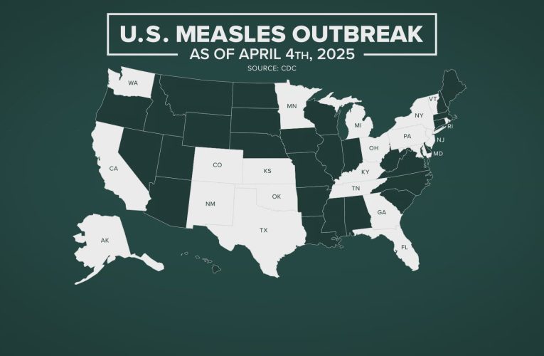 Measles (sarampi), un menasa creciendo